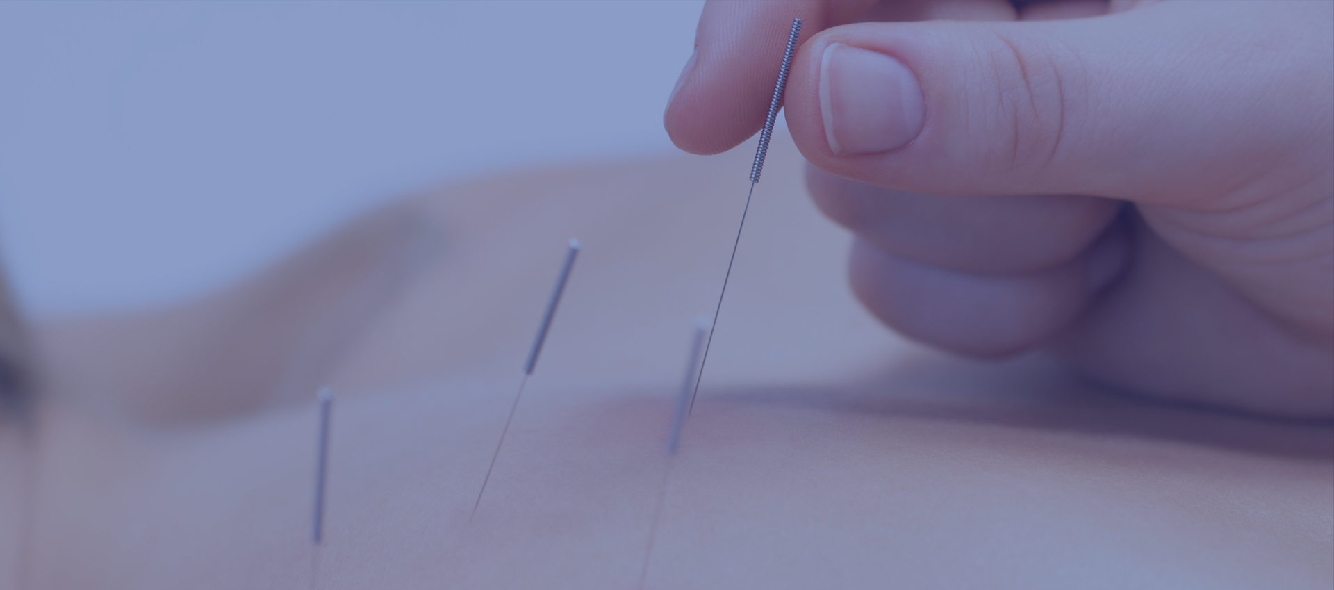 dry needling sandringham